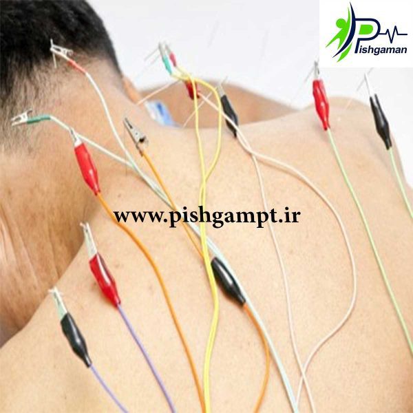 دستگاه الکتروآکوپانچر SDZ 2 RED - Image 5